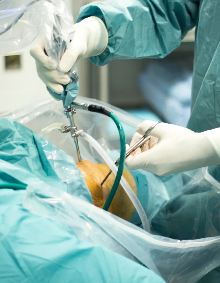 Knee Arthroscopy