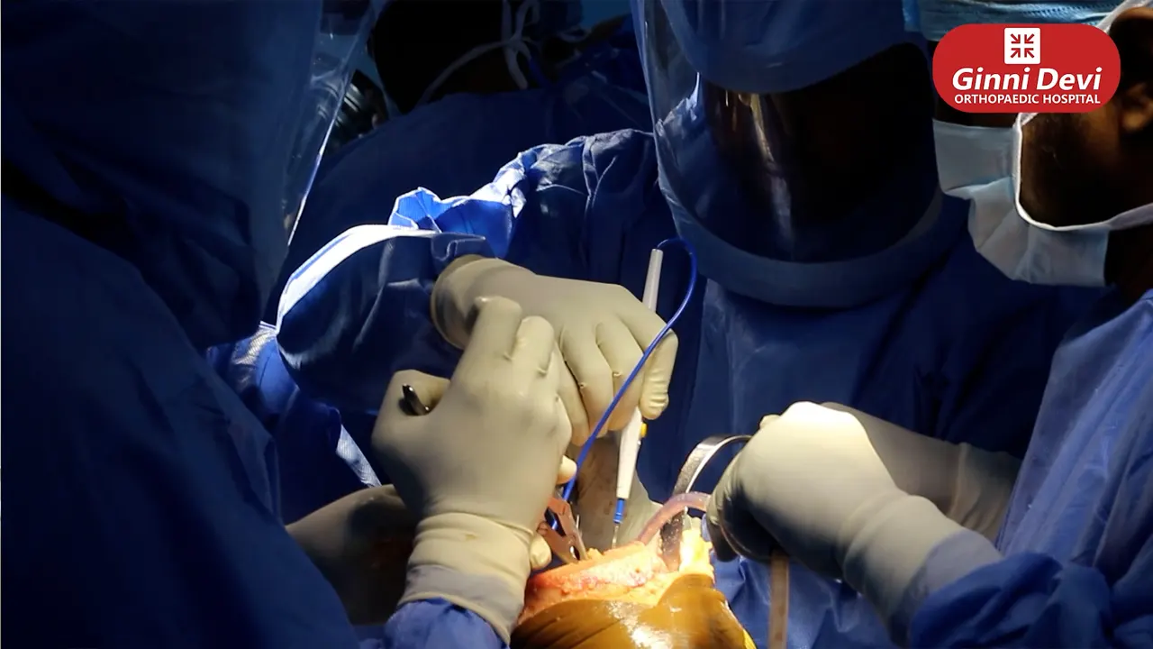 Hip Replacement Surgery