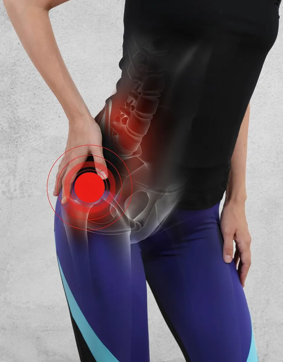 Hip Replacement