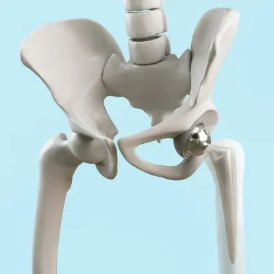 Hip Replacement Surgeon in Jaipur