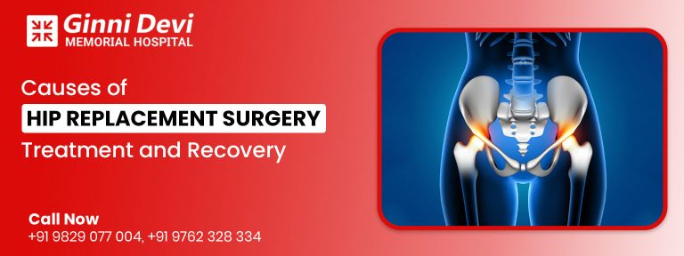 Causes of Hip Replacement Surgery, Treatment and Recovery