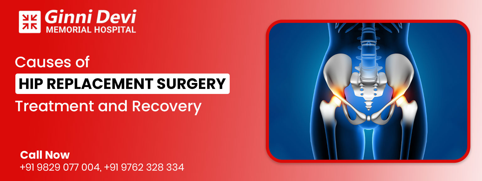 Causes of Hip Replacement Surgery, Treatment and Recovery