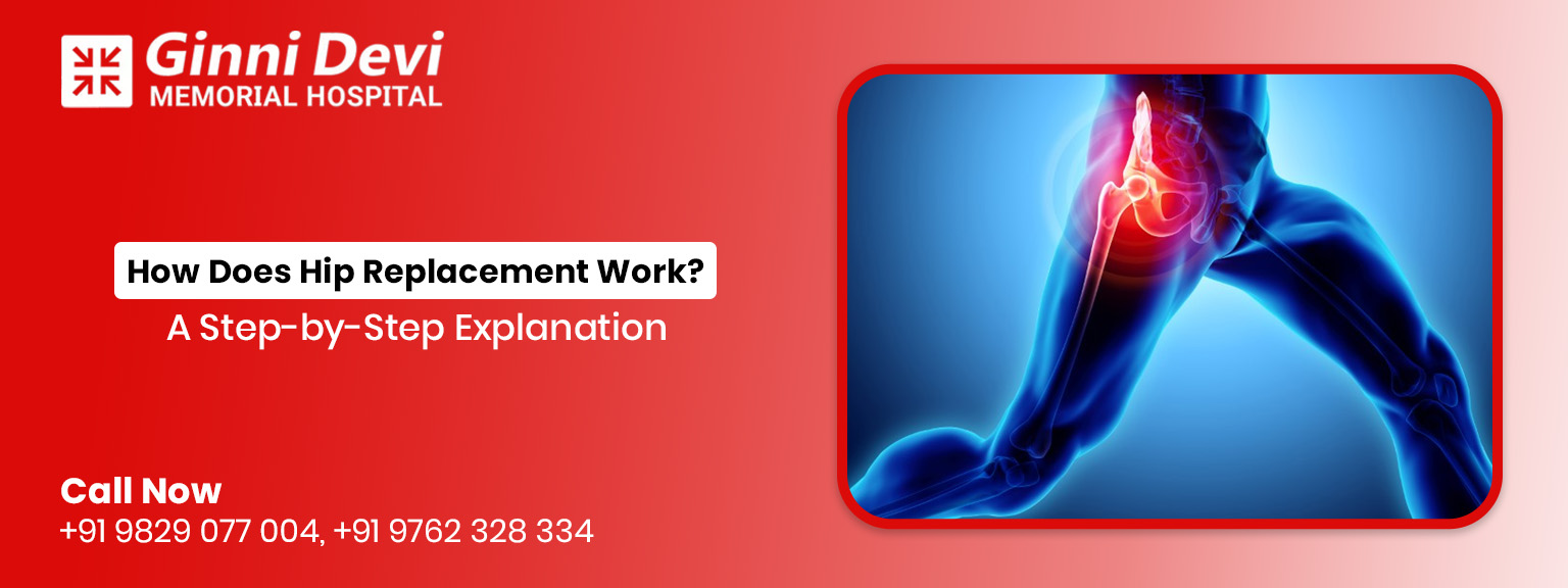 step-by-step explanation of hip replacement