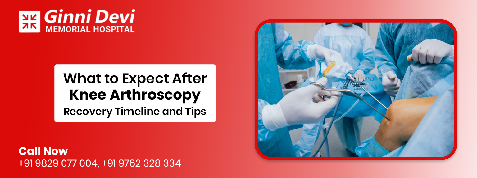 What to Expect After Knee Arthroscopy