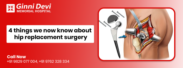 hip replacement surgery