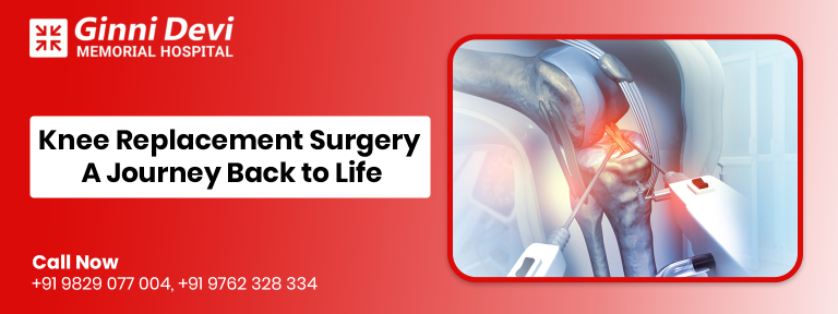 Knee Replacement Surgery: A Journey Back to Life